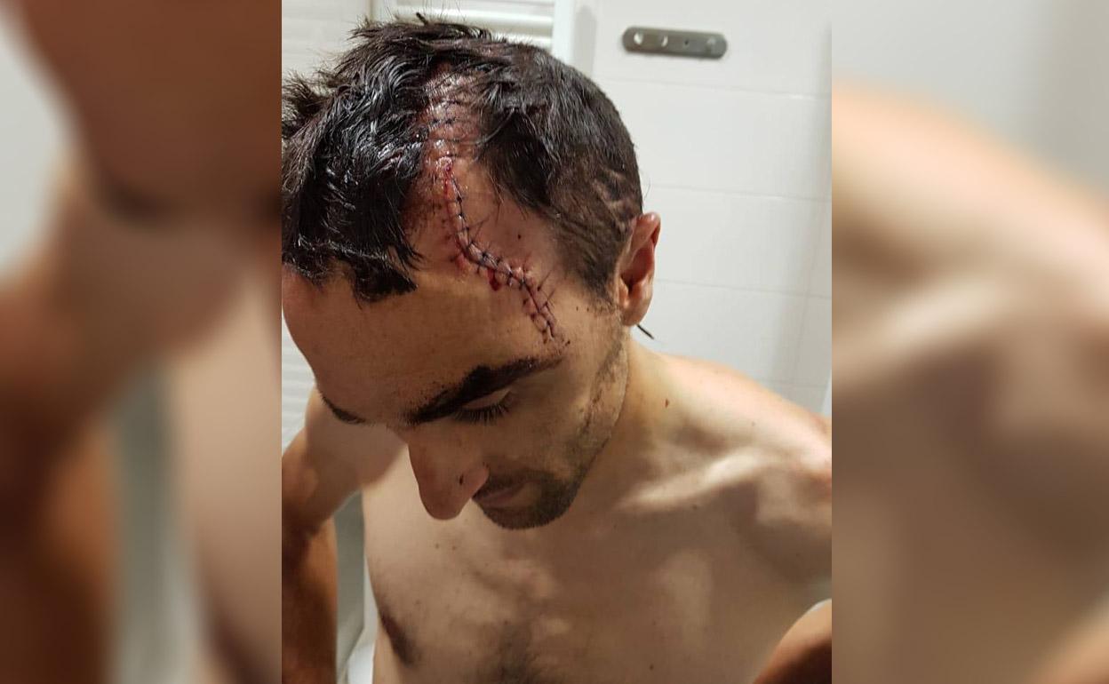 La tremenda brecha en la cabeza de Maté, ayer en el Hospital Ochoa.