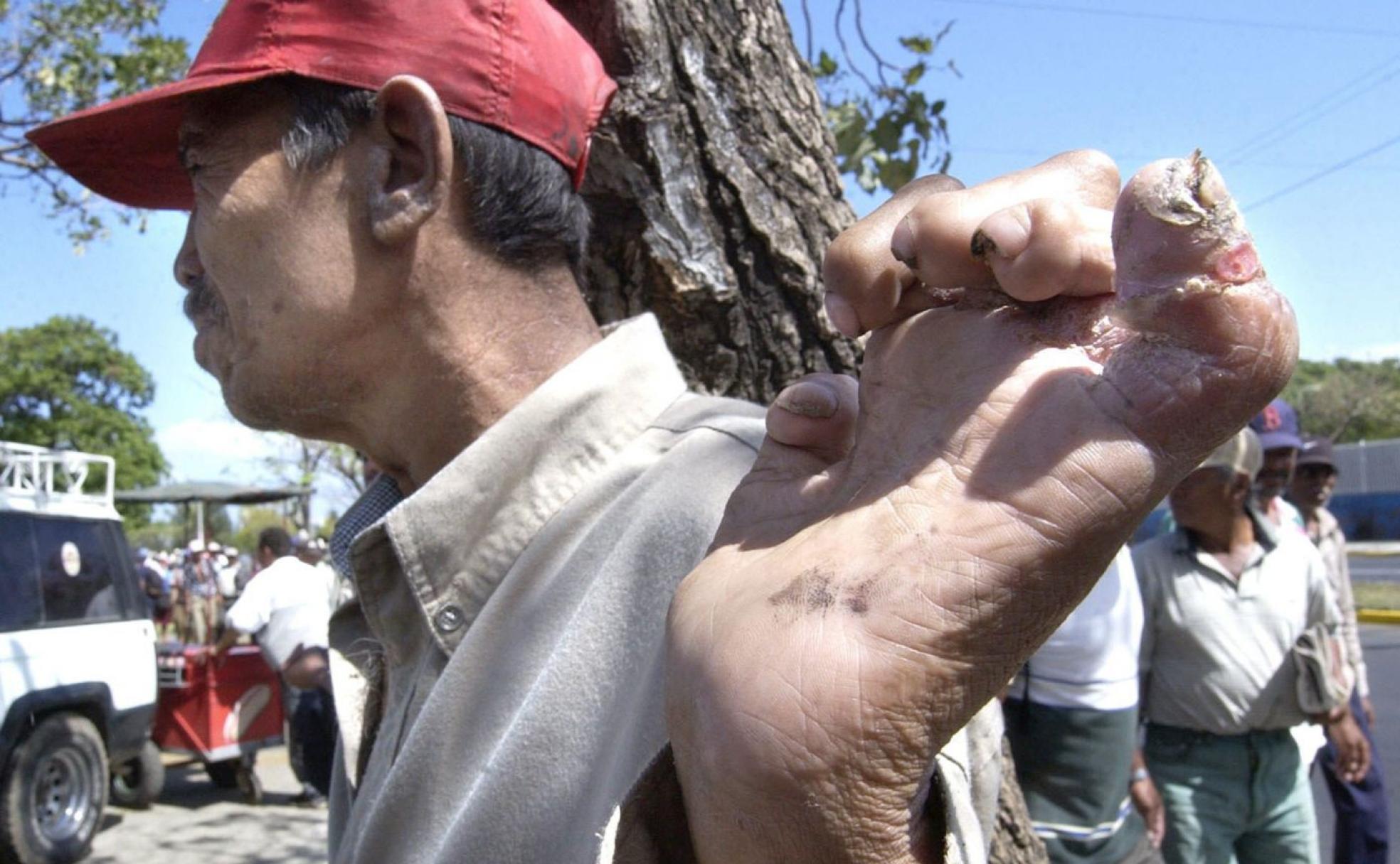 Marcha de trabajadores nicaraguenses afectados por el nemagon para pedir justicia. 