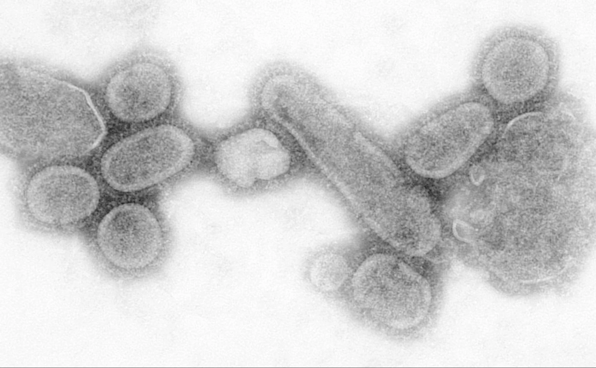 El virus de la gripe AH1N1 fue reconstruido en 2005.