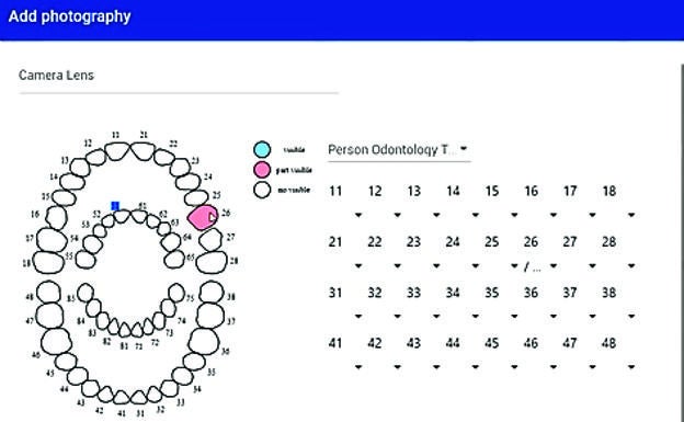 Tras realizar el perfil biológico, los datos de la muestra se incluyen en el software.