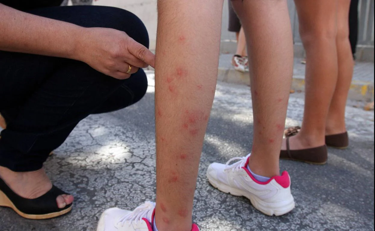 Picaduras de mosquito en las piernas de un niño, en Málaga. 