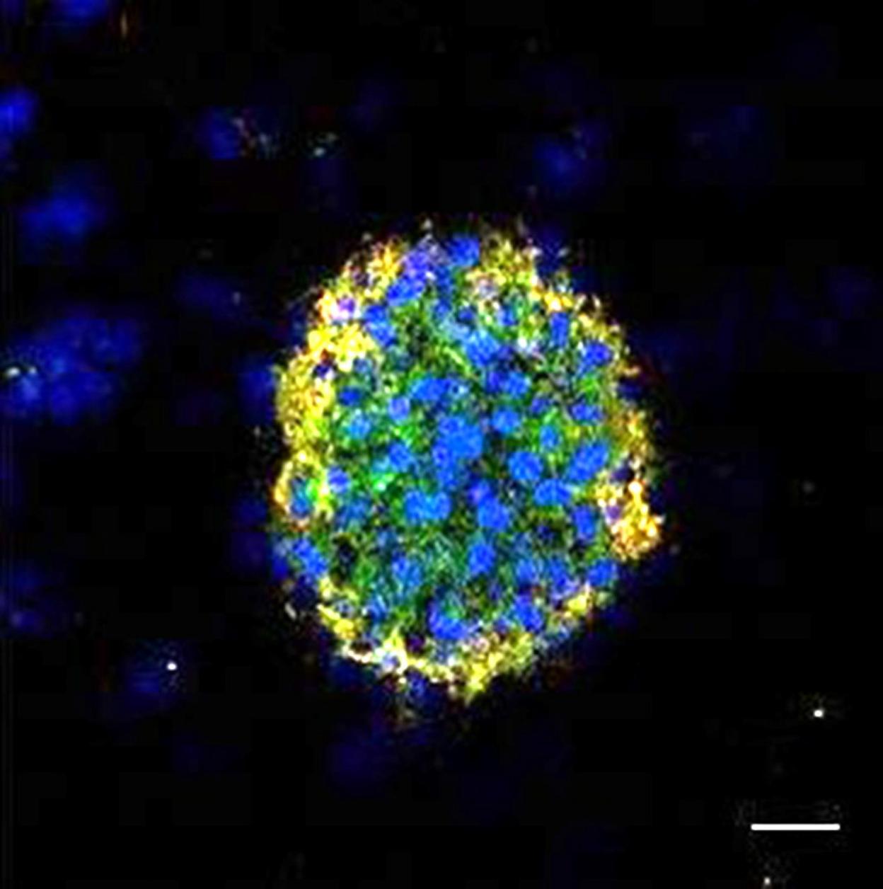 Copias de tumores de mama metastásicos, generadas a partir de células 'pescadas' en la sangre (en azul y verde), acompañadas de algunas células sanguíneas (en rojo). Begoña Hurtado / CNIO