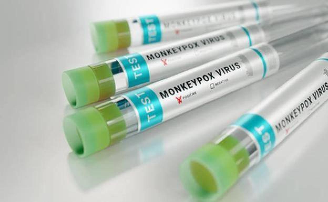 Viruela mono: Málaga sigue con solo dos pacientes con una infección provocada por la viruela del mono