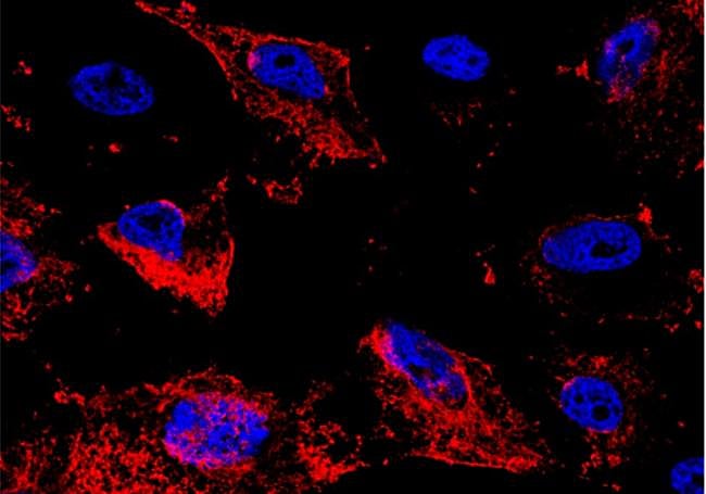 Células con nanopartículas (núcleo en azul, nanopartículas en rojo).