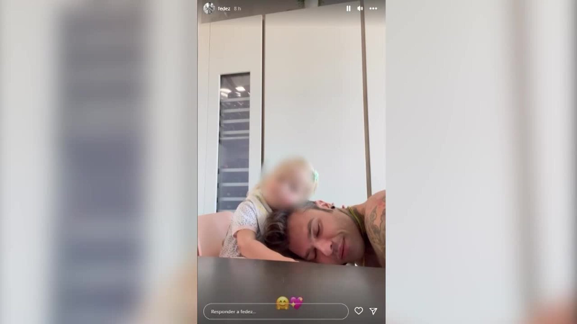 El rapero Fedez experimenta una ligera mejoría en su estado de salud