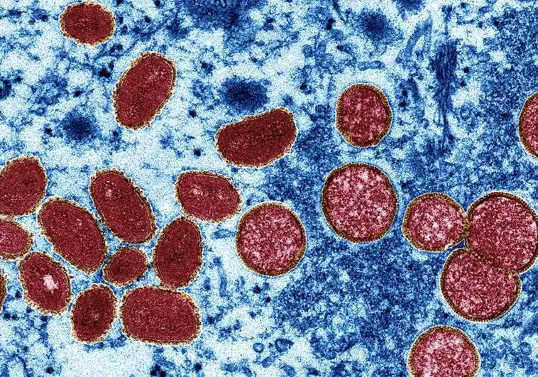 Viruela del mono: origen, cómo se contagia y cuáles son los síntomas del virus Mpox
