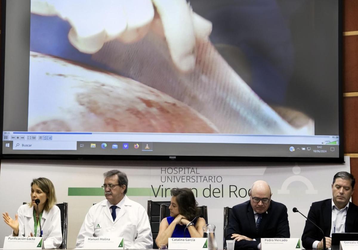 El Virgen del Rocío de Sevilla, primer hospital español autorizado para usar piel humana artificial