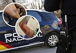 Algunas de las magulladuras que presenta la víctima tras el suceso, ocurrido hace dos semanas.