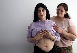 María, junto a su madre, muestra su cicatriz en un reportaje publicado en SUR en 2021