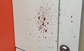 Restos de sangre en los columpios