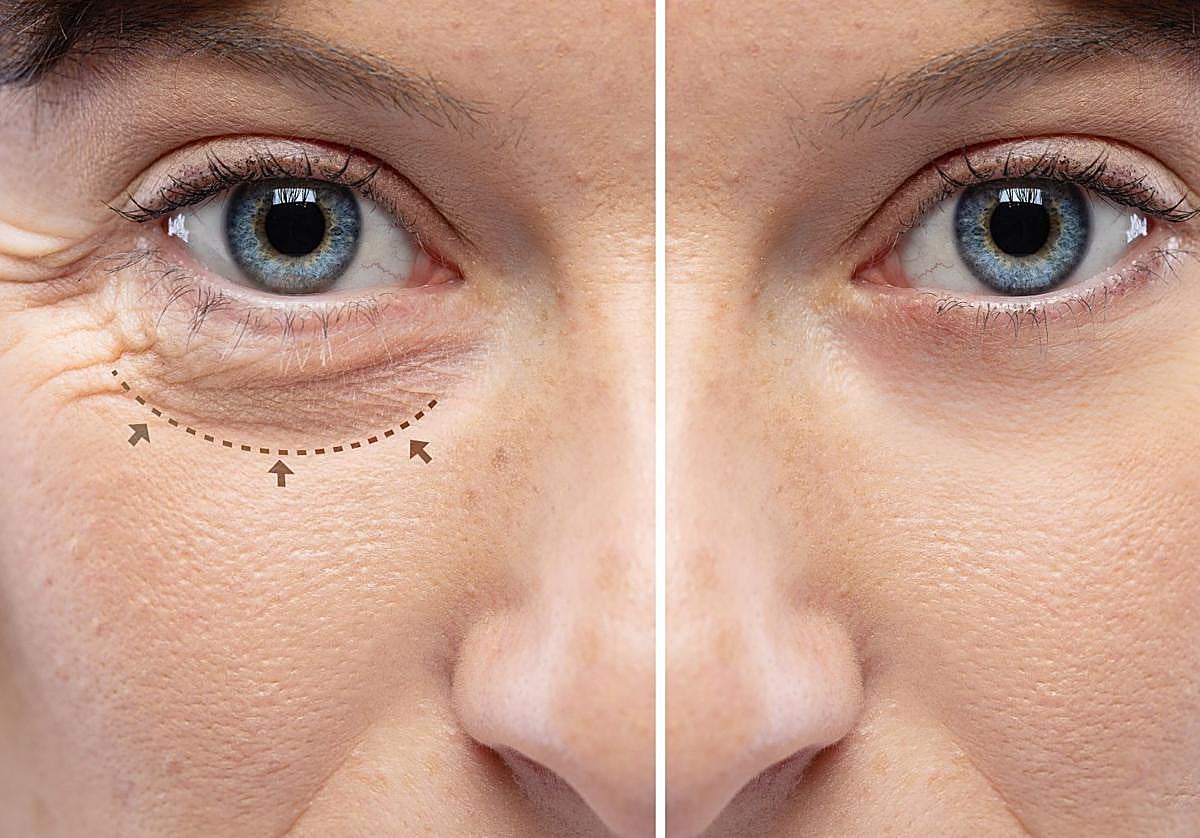 «Una mirada rejuvenecida y descansada influye directamente en la autoestima y bienestar diario»