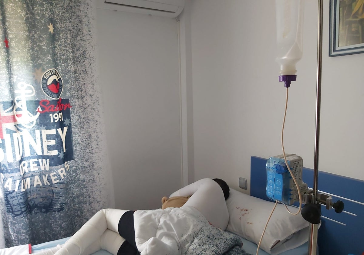 Aprueban un medicamento para cicatrizar heridas de la enfermedad de Piel de Mariposa