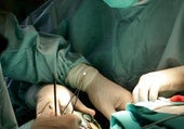 ¿Tienes una prótesis de cadera, hombro o rodilla implantada antes de 2021? Quizás precises de una revisión quirúrgica