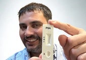 Las farmacias venderán un test para la detección temprana del cáncer de próstata: es de una empresa nacida en la UMA