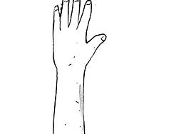 Los médicos no pueden parar el genocidio, los líderes mundiales sí