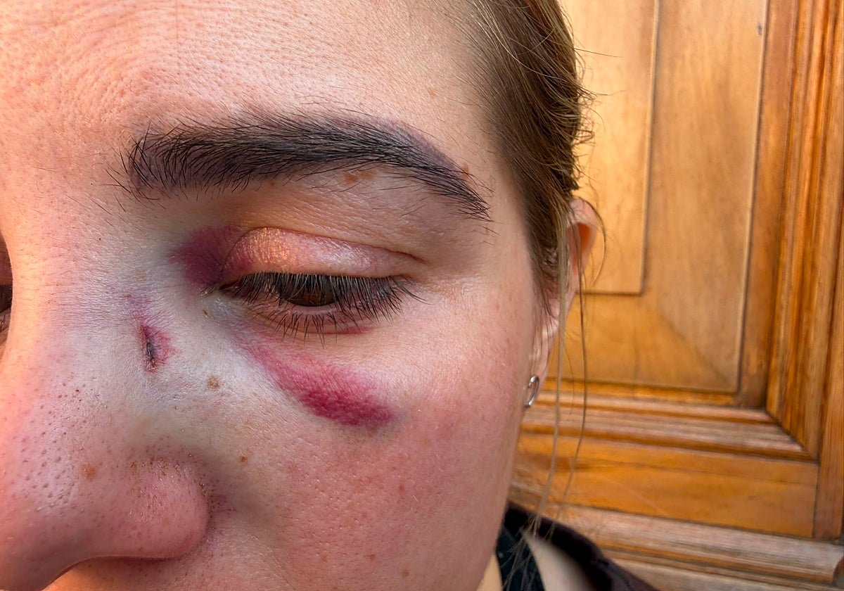 Un paciente rompe de un puñetazo la nariz a una doctora en Villanueva del Rosario