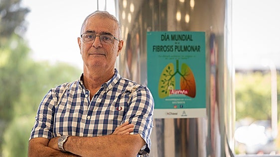 «Las cuestas son lo que más me molesta, me canso mucho»: 200 malagueños conviven con la fibrosis pulmonar