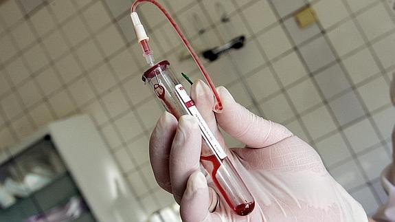 Una enfermera sujeta una muestra de sangre 