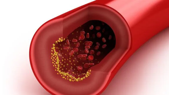 ¿En cuánto tiempo se elimina el exceso de colesterol en la sangre?