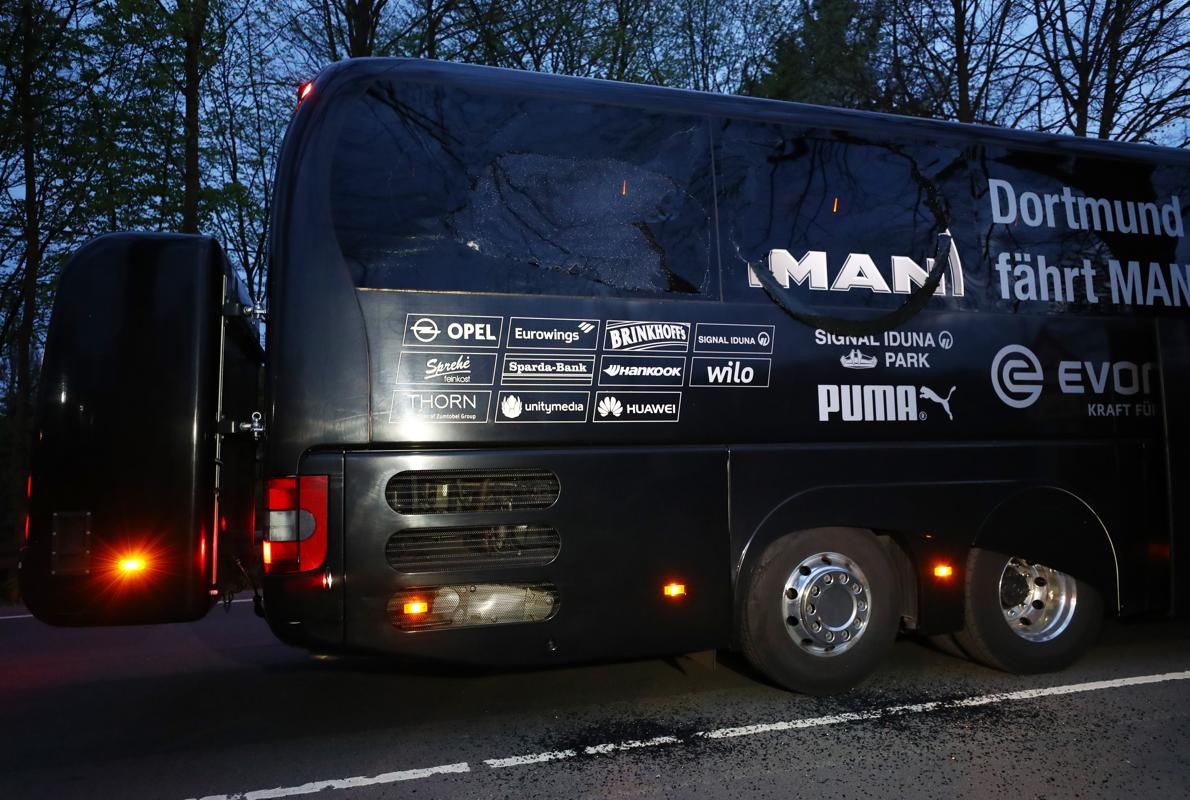 Bartra, operado en la muñeca por el ataque contra el bus del Dortmund