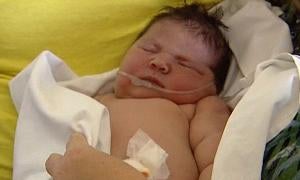 La diabetes descontrolada, principal causa de los 'bebés gigantes'