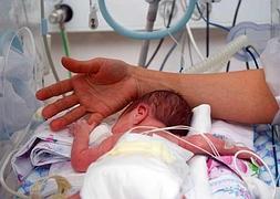 Una recién nacida, que se aferra a la vida, coge el dedo del médico que la visita en la incubadora. :: SUR