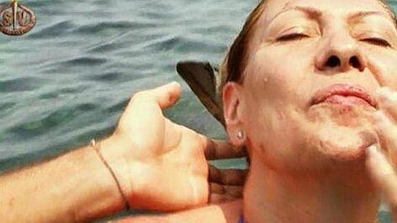 Rosa Benito se hizo daño en un labio