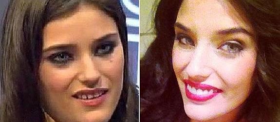 'La Pechotes' luce en la red su nueva sonrisa