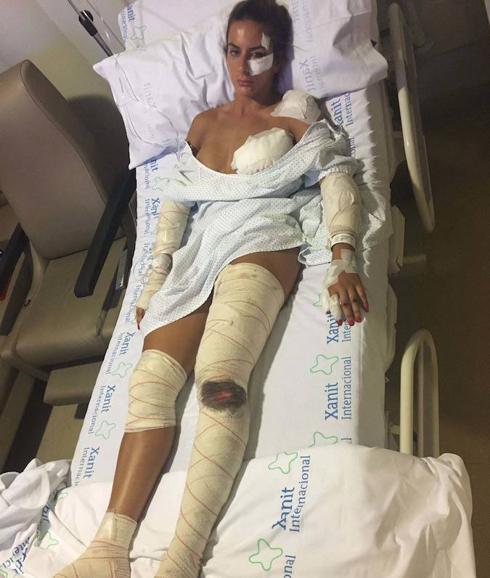 Zamara Rodríguez, en la habitación del hospital, tras el accidente.