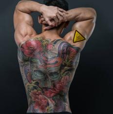 Los dermatólogos recalcan que las pieles tatuadas se queman al sol y en las pruebas de resonancia magnética.