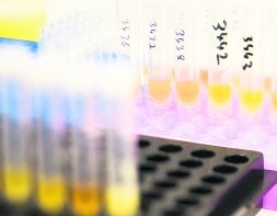 Una simple muestra de orina puede evitar el quirófano. / SUR