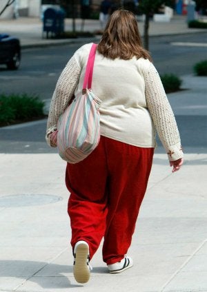 Una cuarta parte de los obesos mórbidos están sanos