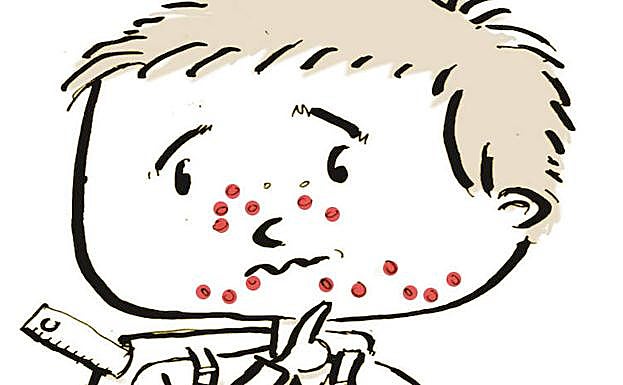 Ilustración de un niño con sarampión. 