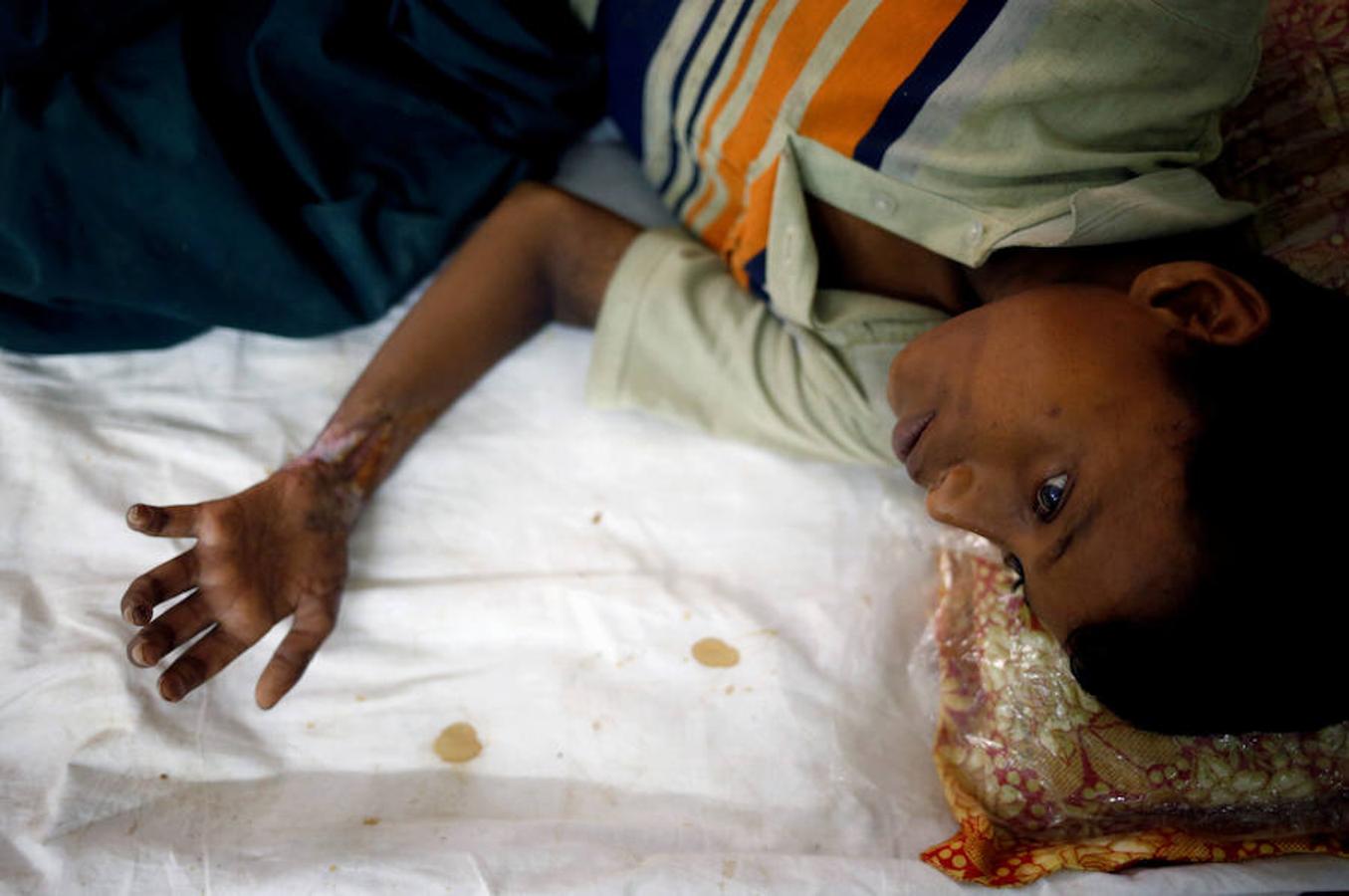 Más de 420.000 refugiados han llegado a Bangladés huyendo de la persecución por parte del ejércido de Myanmar sumergidos en el hambre, las enfermedades y la violencia. Son los rohinyá, una minoria musulmana que pertenece a un país de mayoria budista. La mayor parte de los refugiados son niños que llegan desacompañados y mujeres.