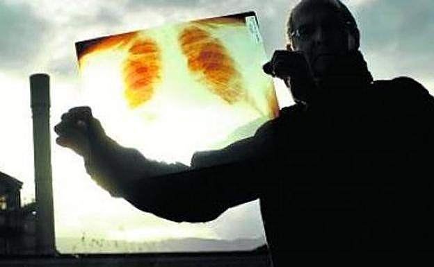 El Tribunal Superior de Justicia del País Vasco ratifica como enfermedad profesional el cáncer de pulmón de un trabajador guipuzcoano