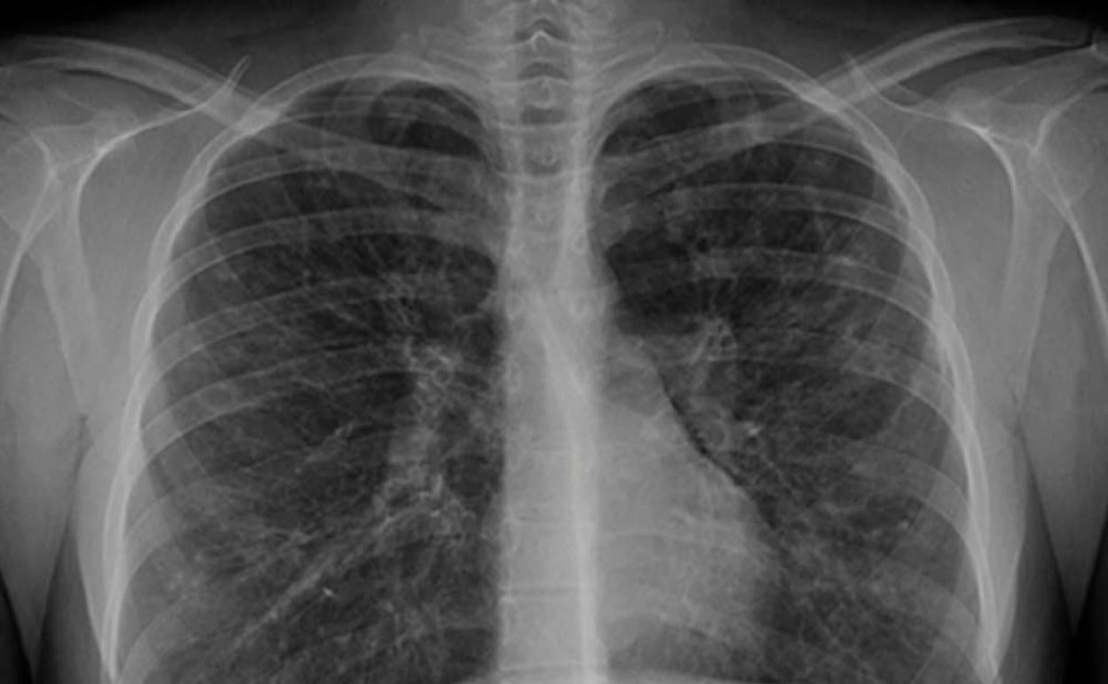 Condenan a pagar 312.000 euros por un mesotelioma