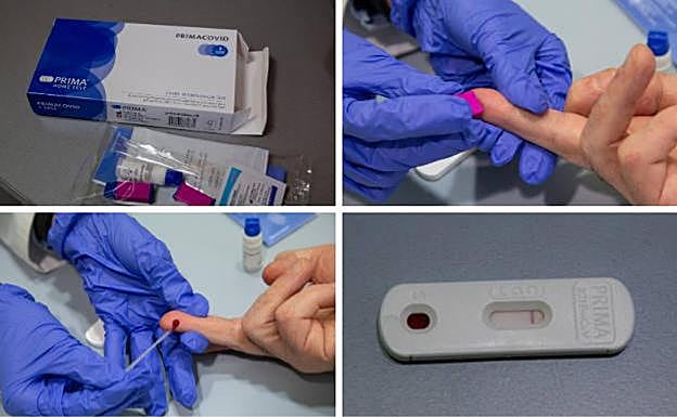 Médicos de familia recomiendan no hacerse los test rápidos de anticuerpos de farmacias porque «no sirven» para diagnosticar el Covid
