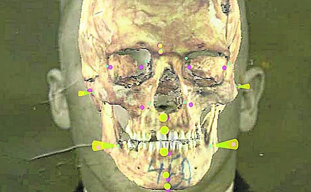 Superposición del cráneo sobre la fotografía según la posición de los 'landmarks'.