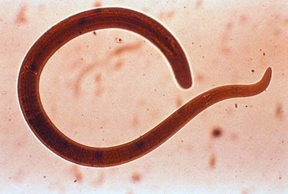 gusanos nematodos en humanos