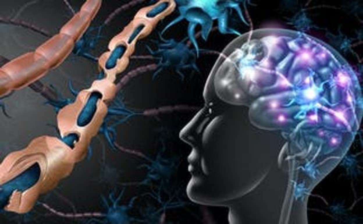 Identificado el virus que causa la esclerosis múltiple