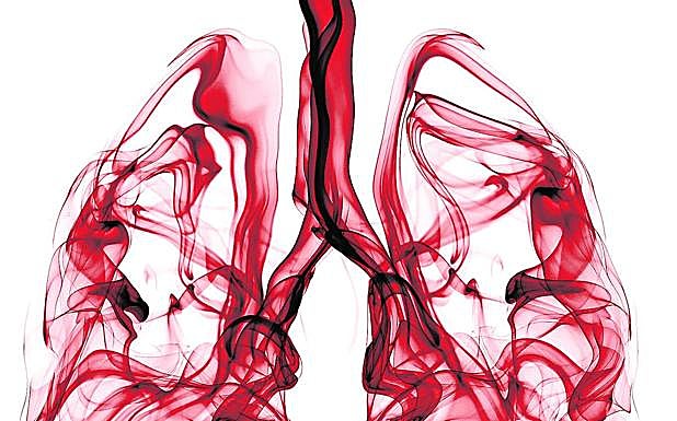 Respirar después de un cáncer de pulmón