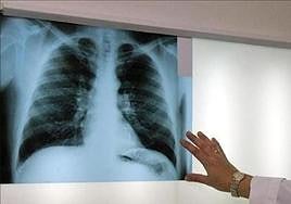 Reconocen dos nuevas incapacidades por amianto a dos pensionistas de Gipuzkoa
