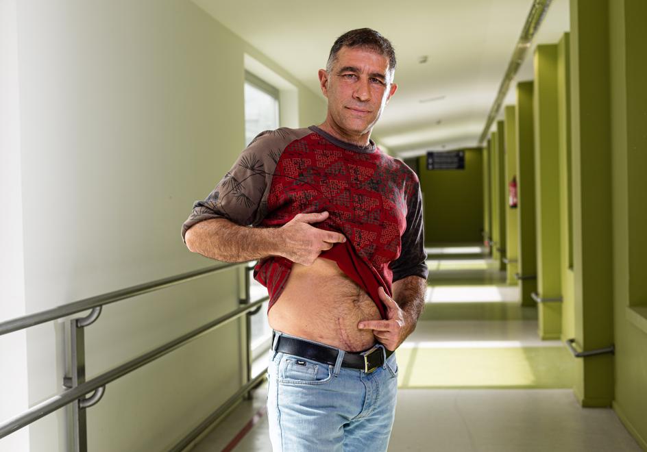 Aitor Palomo muestra la cicatriz que le ha dejado la intervención.