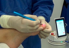 Uñas encarnadas, descubre la solución definitiva