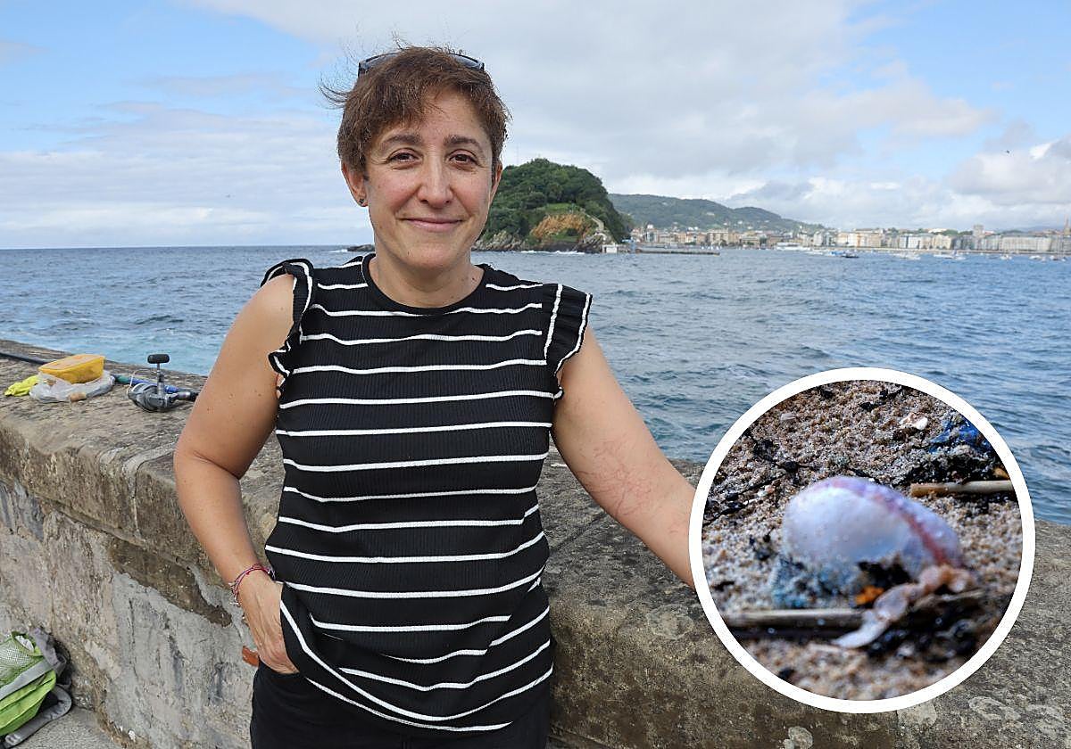 Arantza García enseñalas marcas en el brazo, aún visibles despuésde casi un mes .