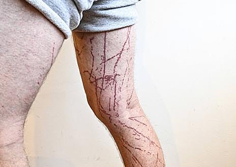 Imagen secundaria 1 - «Sentí una descarga bestial y creí que me moría»