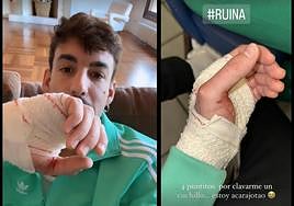 Luitingo explica por qué le han tenido que dar cuatro puntos en la mano