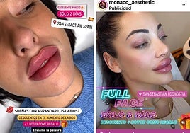 Dos de los anuncios que las mujeres detenidas habían publicado en las redes sociales para captar clientela en la capital guipuzcoana. Ofrecían descuentos y bótox de regalo.
