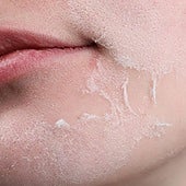 Una dermatóloga vasca avisa de los efectos de un conocido producto cosmético: «Tu piel puede descamarse»