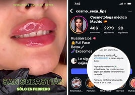 Pantallazos de la cuenta de Instagram y de mensajes privados entre la falsa cosmetóloga y la colegiada del Colegio Oficial de Médicos de Gipuzkoa aportados por Comgi en su denuncia.